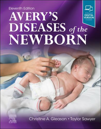 9780323828239 Avery's Diseases Of The Newborn
