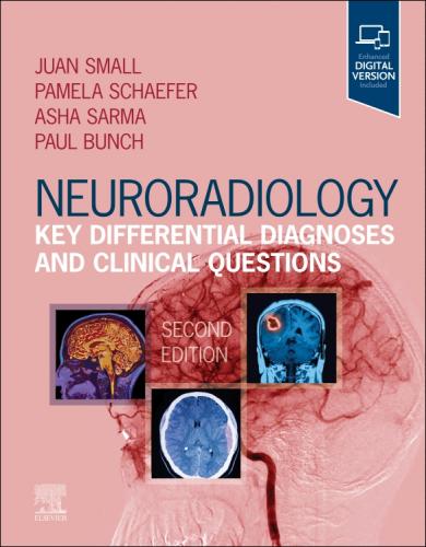 9780323847612 Neuroradiology: Key Differential Diagnoses & Clinical...