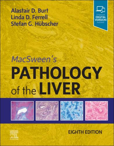 9780702082283 Macsween's Pathology Of The Liver