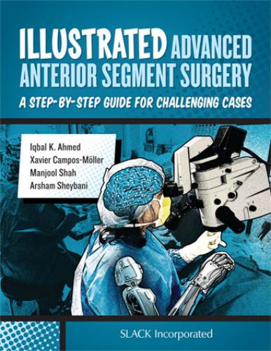 9781630911843 Illustrated Advanced Anterior Segment Surgery
