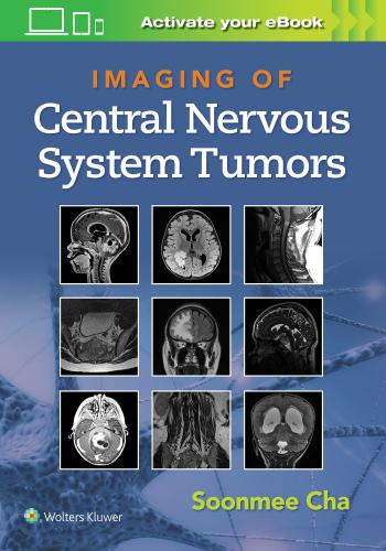 9781975103743 Imaging Of Central Nervous System Tumors