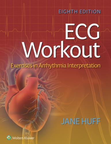 9781975174545 Ecg Workout: Excerises In Arrhythmia Interpretation