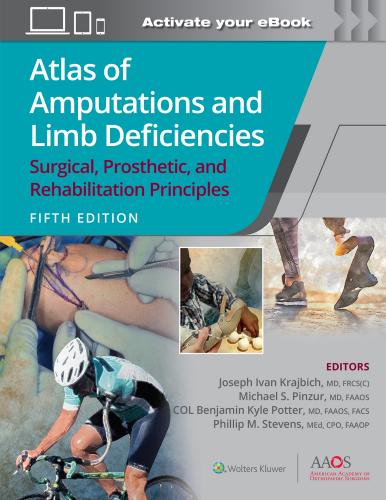 9781975184452 Atlas Of Amputations & Limb Deficiencies