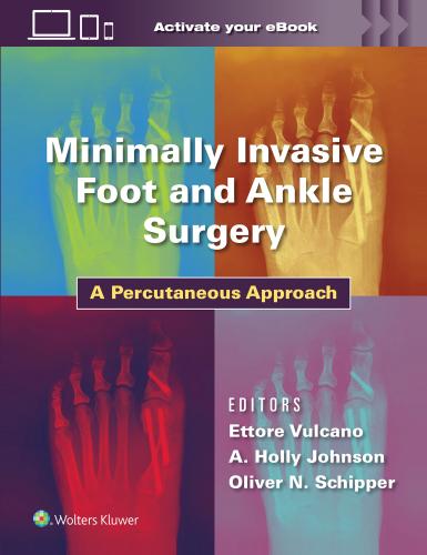 9781975198701 Minimally Invasive Foot & Ankle Surgery: A Percurtaneous...