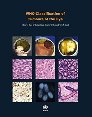 9789283244974 Who Classification Of Tumours Of The Eye (1 Vol)
