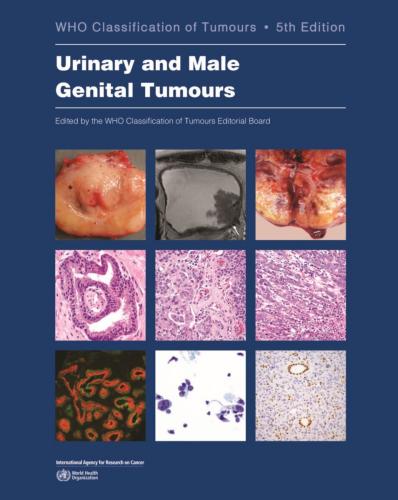 9789283245124 Who Classification Of Urinary & Male Genital Tumours