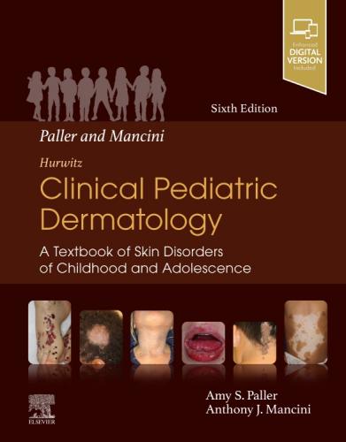 9780323549882 Paller & Mancini - Hurwitz Clinical Pediatric Dermatology