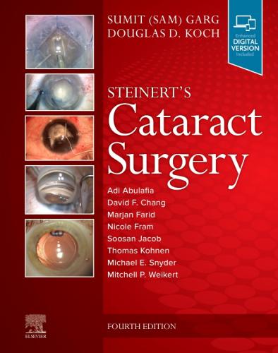 9780323568111 Steinert's Cataract Surgery