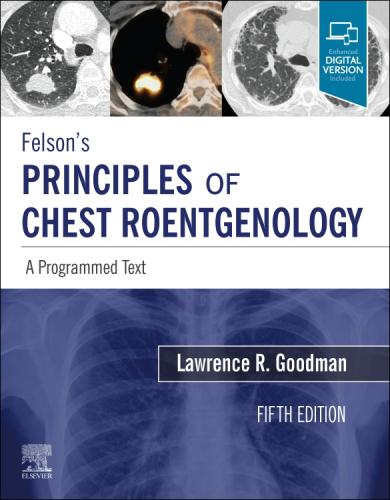 9780323625678 Felson's Principles Of Chest Roentgenology: A Programmed...