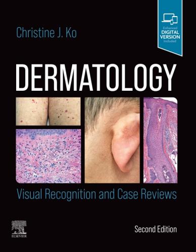9780323697255 Dermatology: Visual Recognition & Case Reviews