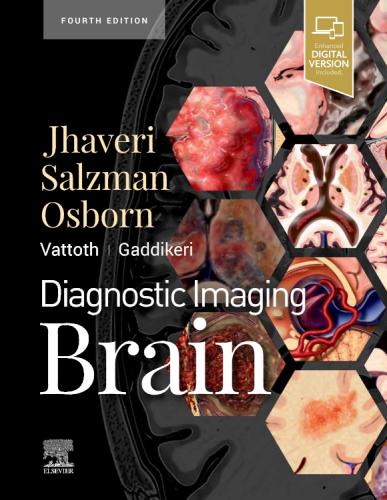 9780323756204 Diagnostic Imaging: The Brain