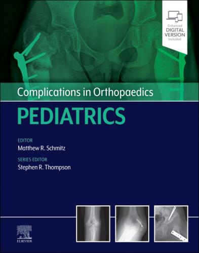 9780323873970 Complications In Orthopaedics: Pediatrics