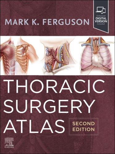 9780323930222 Thoracic Surgery Atlas
