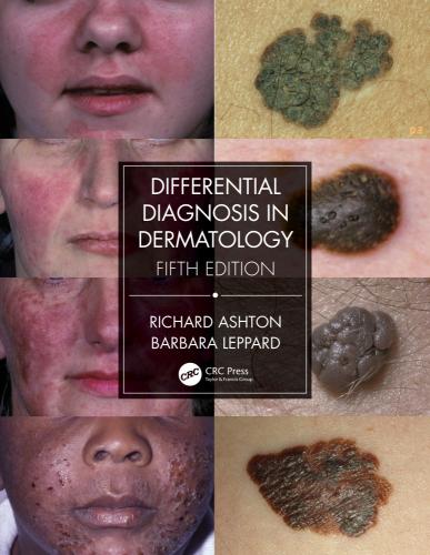 9780367085971 Differential Diagnosis In Dermatology