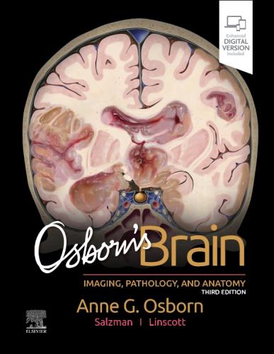 9780443109379 Osborn's Brain