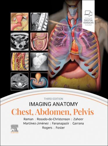 9780443118005 Imaging Anatomy: Chest, Abdomen, Pelvis