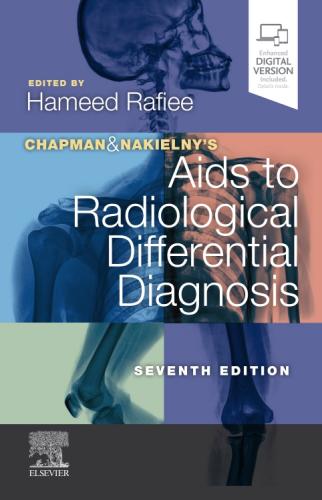 9780702075391 Chapman & Nakielny's Aids To Radiological Differential...