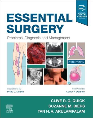 9780702076312 Essential Surgery: Problems, Diagnosis & Management