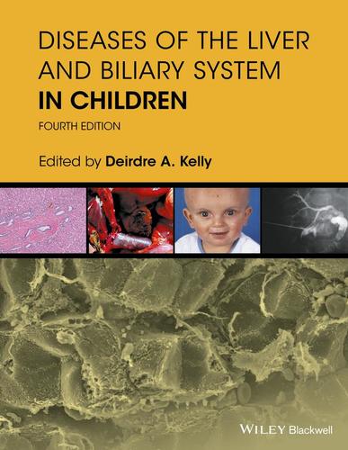 9781119046905 Diseases Of The Liver & Biliary System In Children