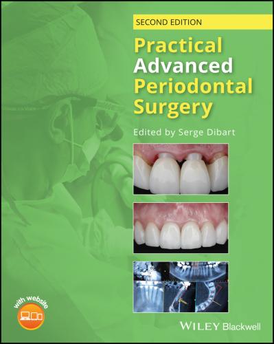 9781119196310 Practical Advanced Periodontal Surgery
