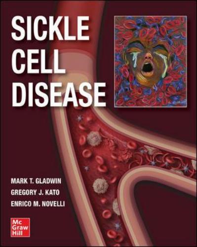 9781260458596 Sickle Cell Disease