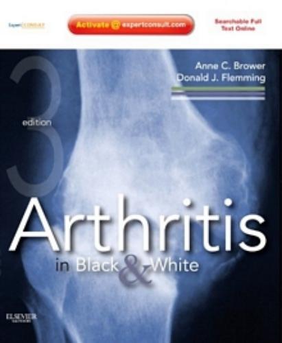 9781416055952 Arthritis In Black & White: Expert Consult-Online & Print