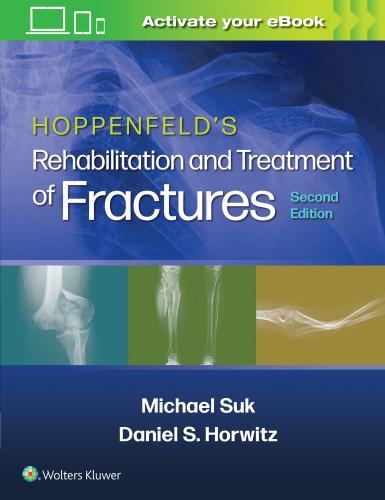 9781451185683 Hoppenfeld's Rehabilitation & Treatment Of Fractures
