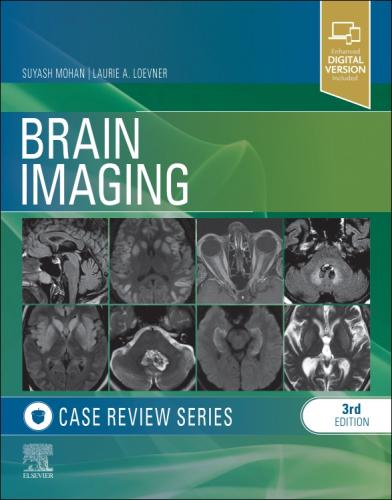 9781455774852 Brain Imaging: Case Review Series