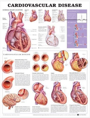 9781496369796 Cardiovascular Disease (Laminated Wall Chart)