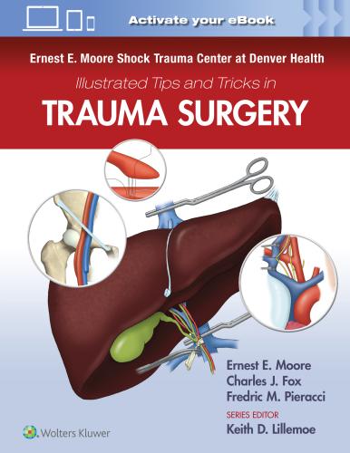 9781975109516 Ernest E. Moore Shock Trauma Center At....... Trauma Surgery