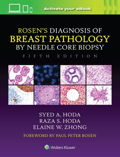 9781975198367 Rosen's Diagnosis Of Breast Pathology By Needle Core Biopsy