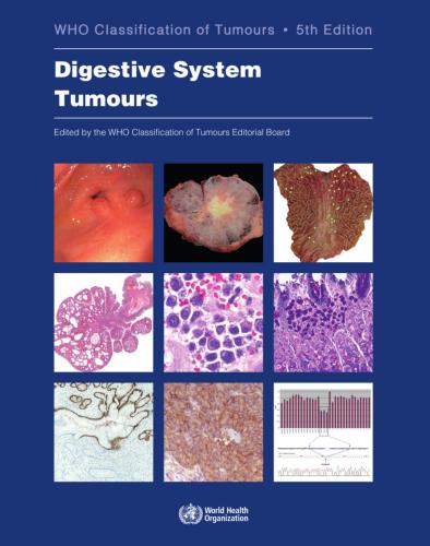 9789283244998 Who Classification Of Digestive System Tumours