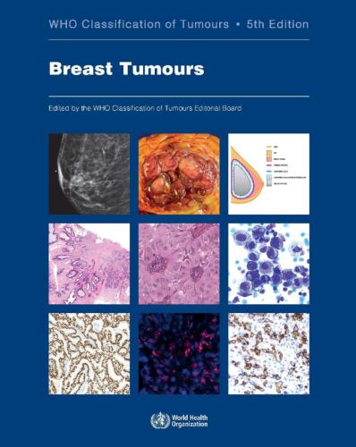 9789283245001 Breast Tumours: Who Classification Of Tumours