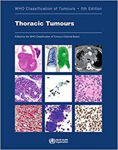 9789283245063 Who Classification Thoracic Tumors